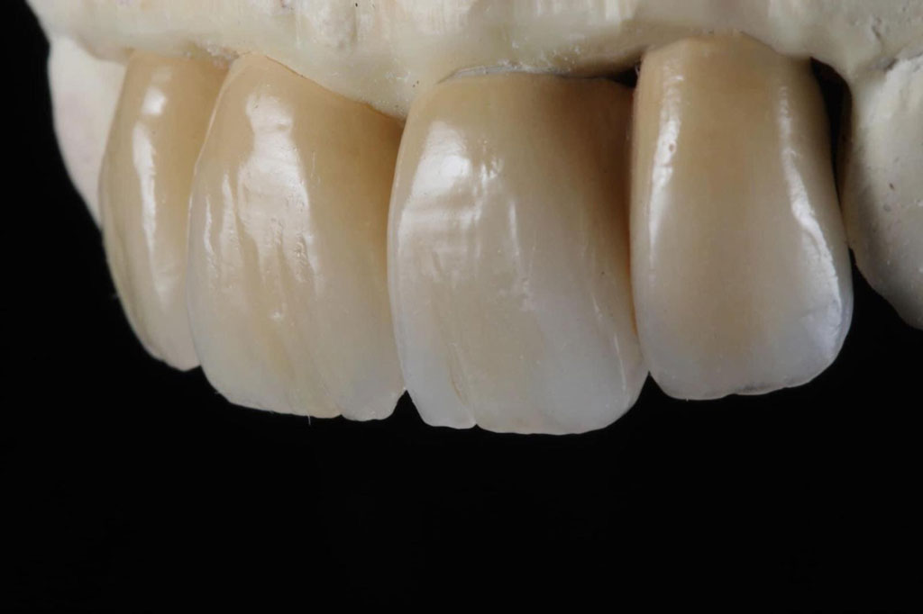 Paolo Pelleri odontotecnico implantologia dentali
