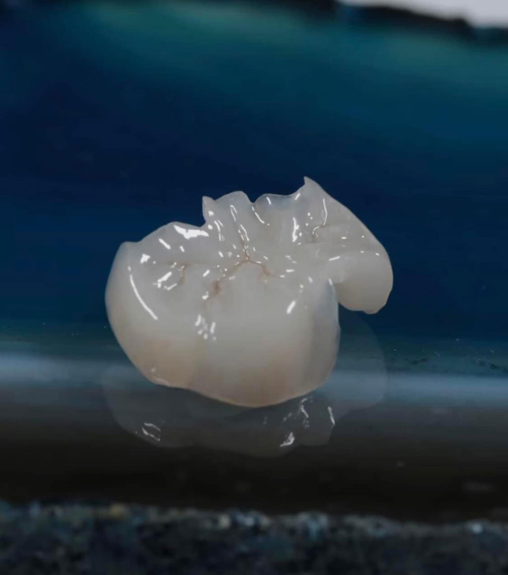 ricostruzioni dentali - Pelleri odontotecnico