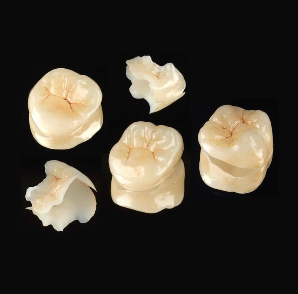 Pelleri laboratorio odontotecnico Vezuolo (Cuneo)